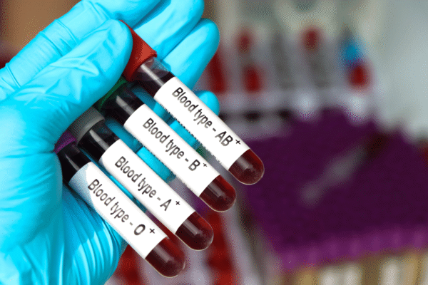 Blood Group Test