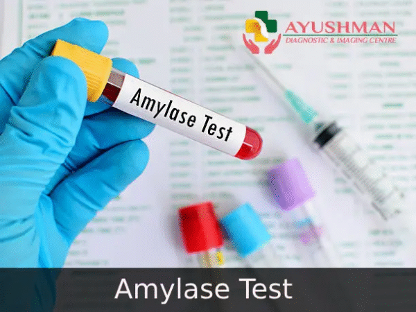 Amylase Test