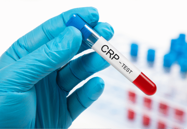 CRP Test