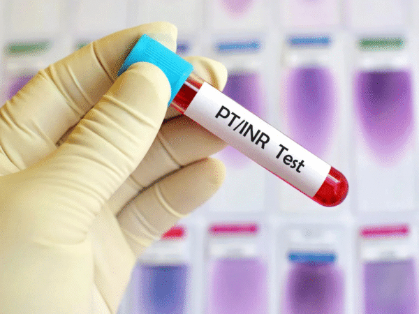 PT-INR Test