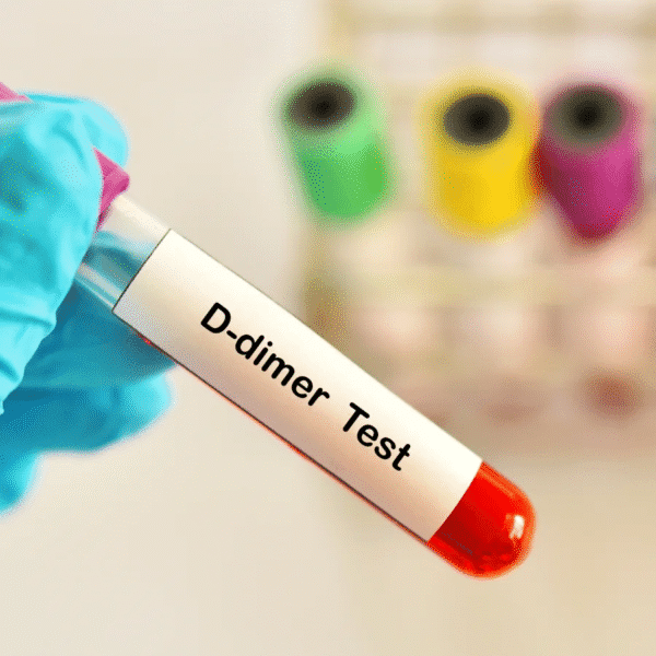 D-Dimer Test