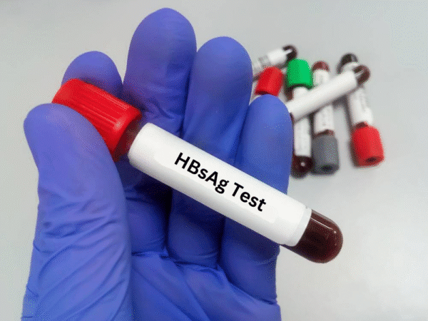 HBsAg Test