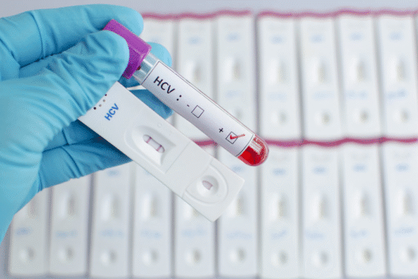 HCV Test