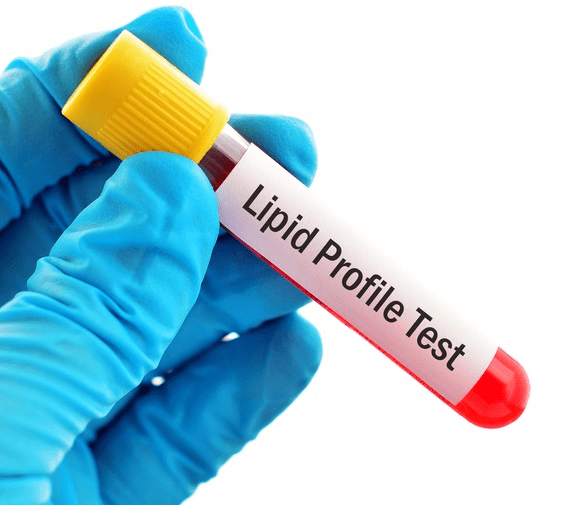 Lipid Profile Test