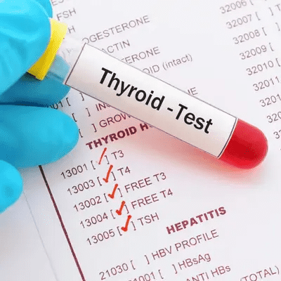 Free Thyroid Profile Test