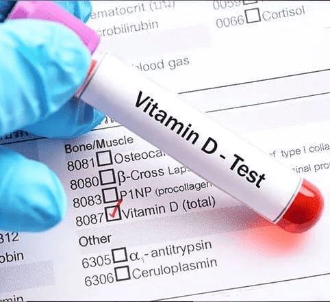 Vitamin D3 Test