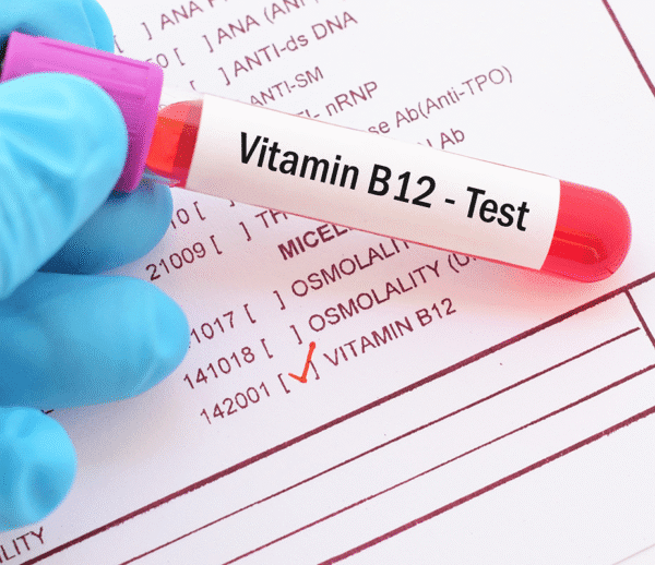 Vitamin B12 Test