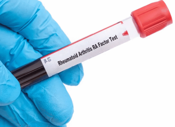RA-Factor Test