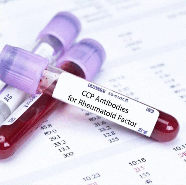 Anti-CCP Test