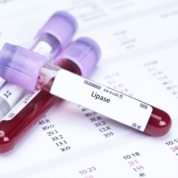 Lipase Test