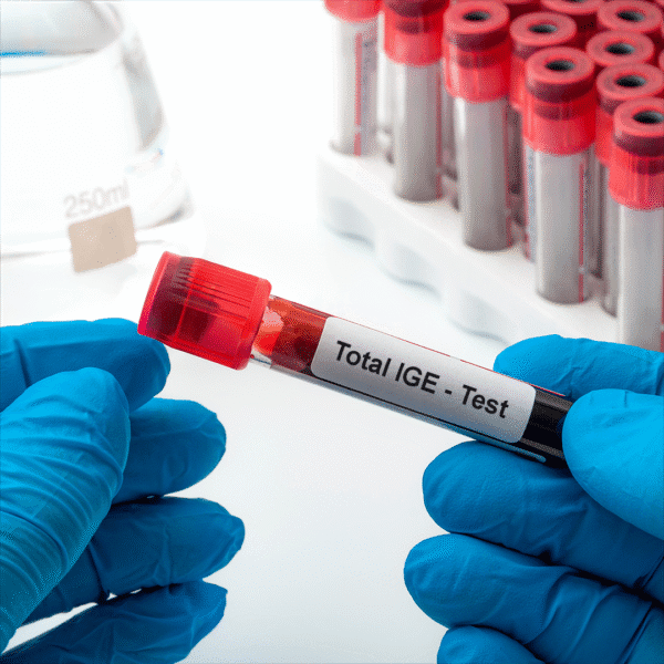 Total IGE Test