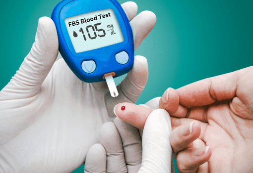 Glucose Fasting Test