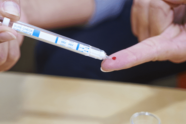 HIV Rapid Test
