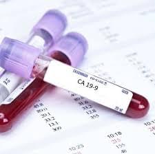 CA19.9 - Pancreatic Cancer Marker